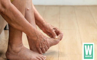 SWOLLEN ANKLES IN SENIORS – What you can do