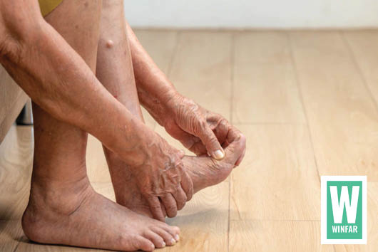SWOLLEN ANKLES IN SENIORS – What you can do